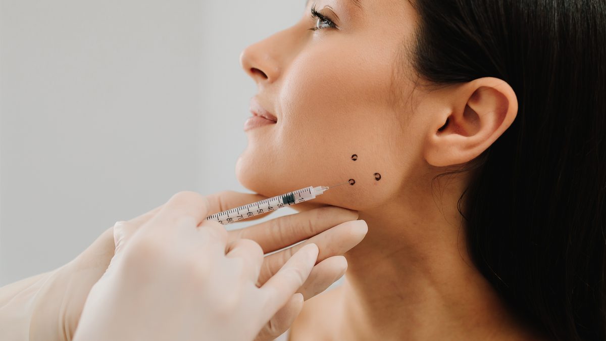 Botox no masseter em Lisboa — injeção com pontos marcados para bruxismo e redução do maxilar na Cosmo Clinic