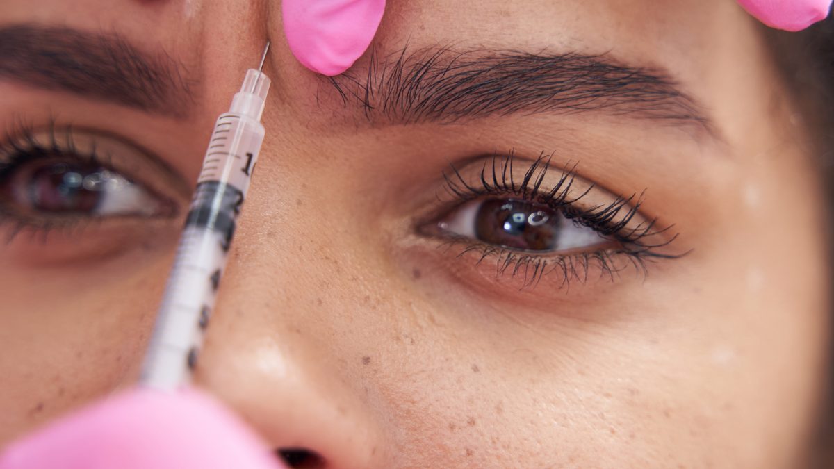 Brow lift com botox em Lisboa — injeção precisa na zona da sobrancelha na Cosmo Clinic