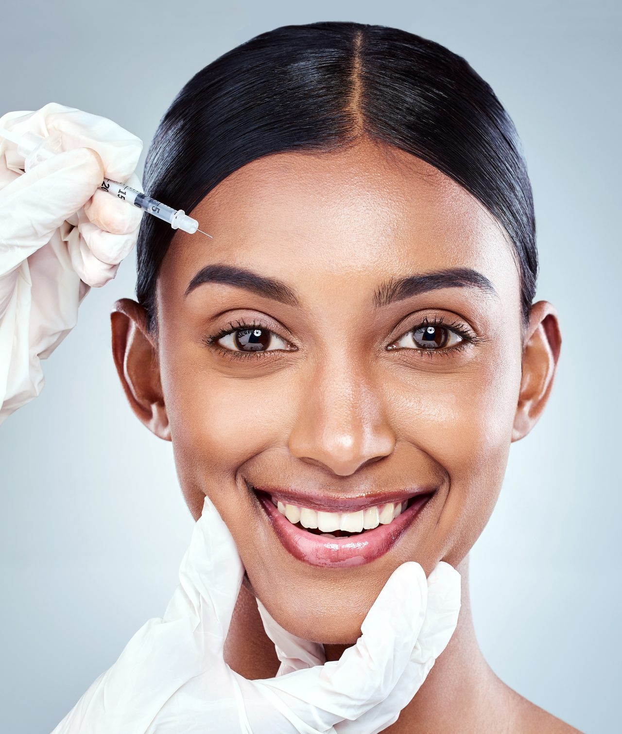 Resultado natural de botox preventivo — Cosmo Clinic Lisboa