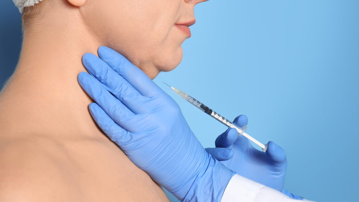 Eliminação da papada sem cirurgia em Lisboa — tratamento com injeção na Cosmo Clinic