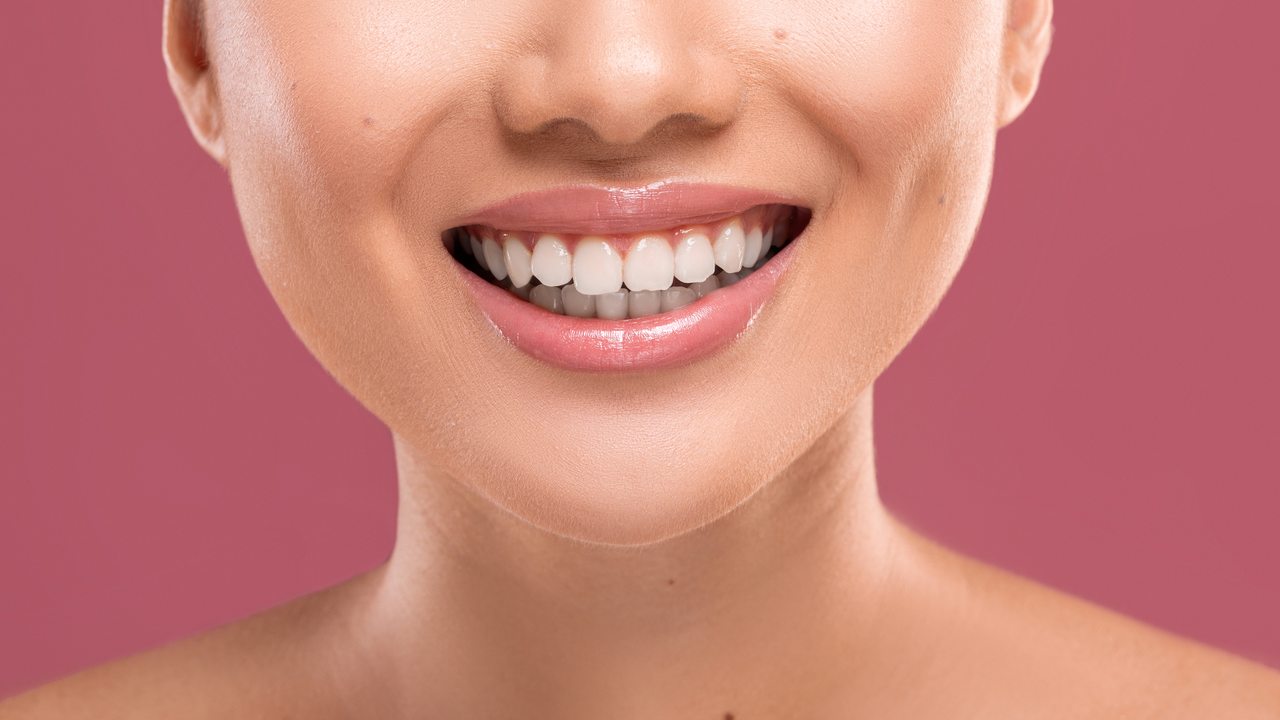 Resultado natural de preenchimento labial subtil — lábios definidos sem exagero na Cosmo Clinic