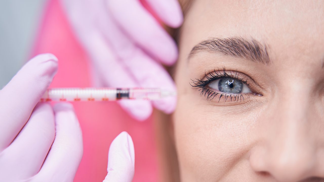 Preenchimento de olheiras com micro-injeção na área periorbital