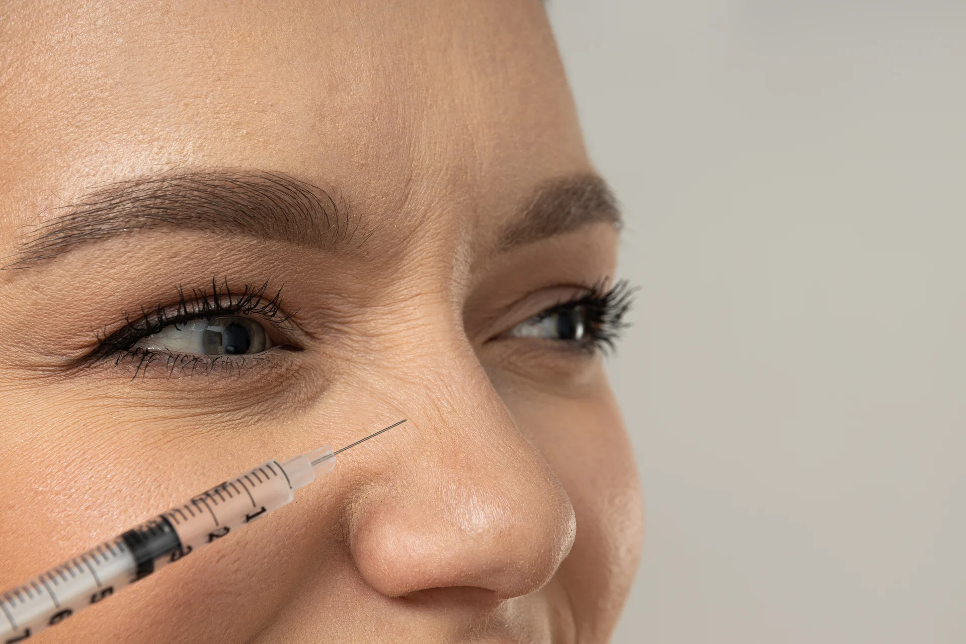 Detalhe da aplicação de Botox nas bunny lines