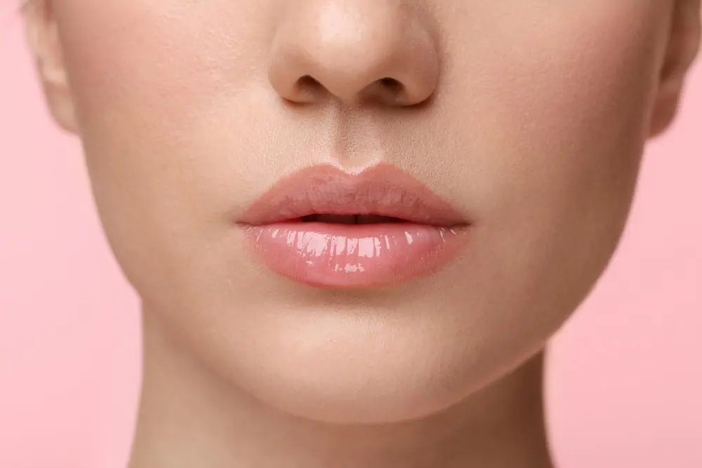 Preenchimento labial natural, exemplo de resultado harmonioso